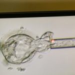 Bayi Ajaib Lahir! Embrio 31 Tahun Pecahkan Rekor!