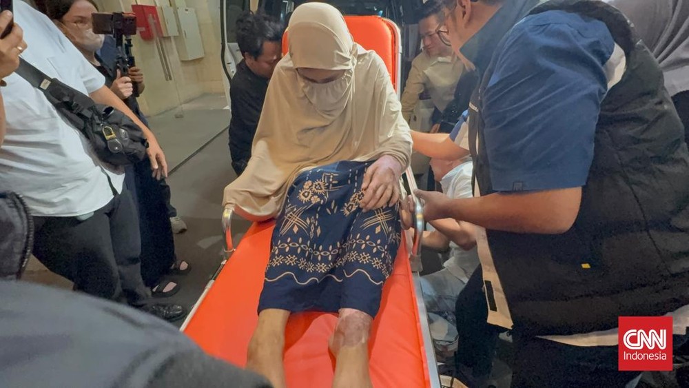 Terkuak Derita Wanita Disiksa Oknum Polisi Disiram Air Keras