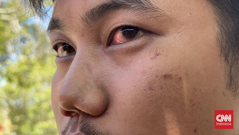 Perwira Tinggi Polisi Diduga Aniaya Pengendara