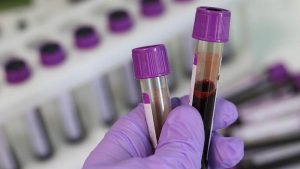 Waspada Golongan Darah B Rentan Diabetes