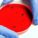 Waspada Virus Ternak Menyerang Manusia