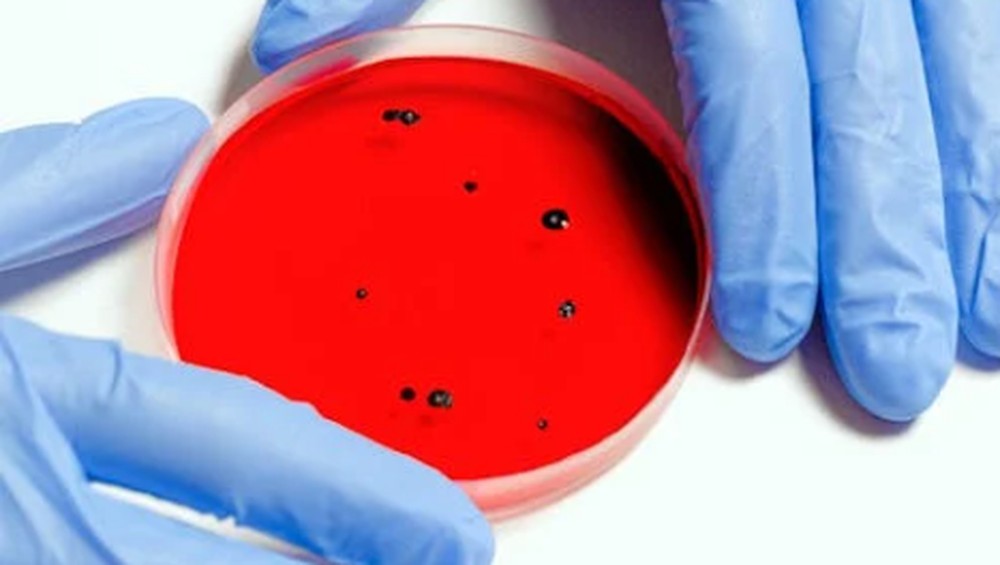Waspada Virus Ternak Menyerang Manusia